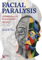 Facial Paralysis, A Comprehensive Rehabilitative Approach