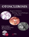 Otosclerosis, Diagnosis, Evaluation, Pathology, Surgical Techniques, and Outcomes